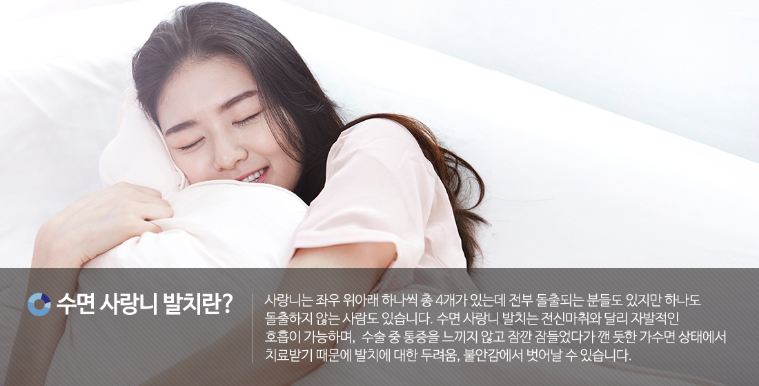 수면사랑니란