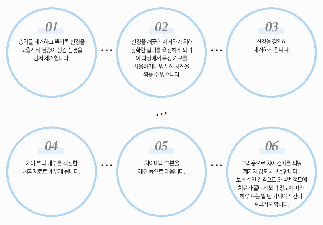 신경치료과정6가지